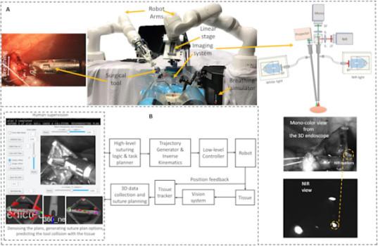 Robot performs complex 'keyhole' intestinal surgery on pigs without human aid1